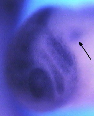 mycn /N-myc expression in stage 23 embryo in CNS, eye, neural crest and pronephric kidney.